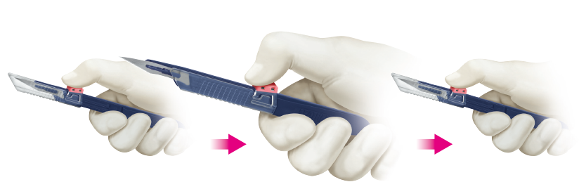 Safeshield scalpel Before use While using After use